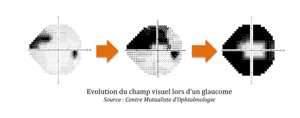 Image retirée.