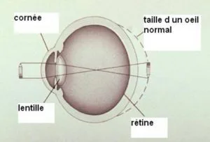 Image retirée.