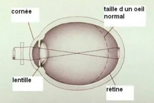 Image retirée.