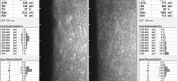 microscopiespeculaire